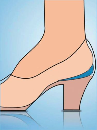 Inserts pour talon 1 paire - Witt - Modalova